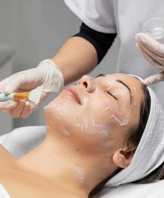 Chemical Peel Treatment